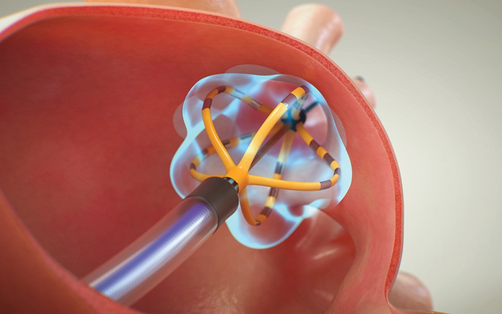 2025年报：电生理失速，波士顿科学盛极而衰？