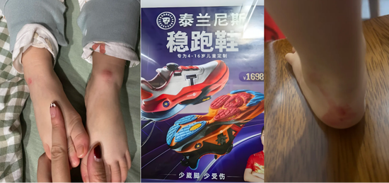 千元童鞋把脚穿肿？泰兰尼斯遭家长“围攻”，医生警惕影响发育，90%专利竟是外观设计